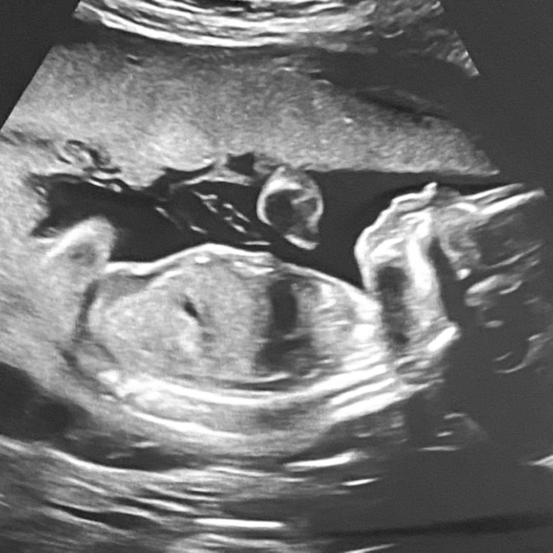 Photo shared by Athena for their Babylist baby registry.