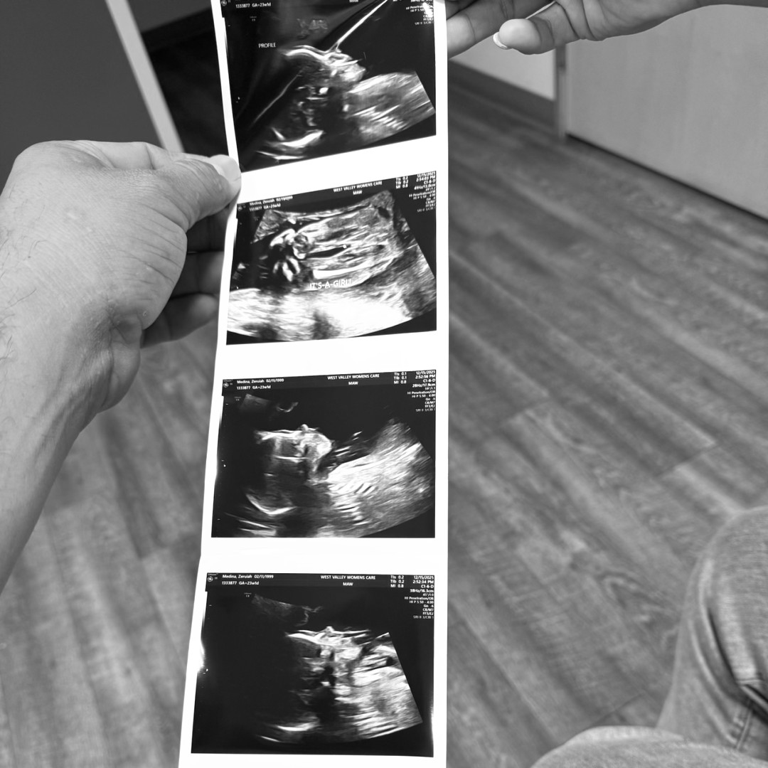 Photo shared by Zeruiah & jose for their Babylist baby registry.