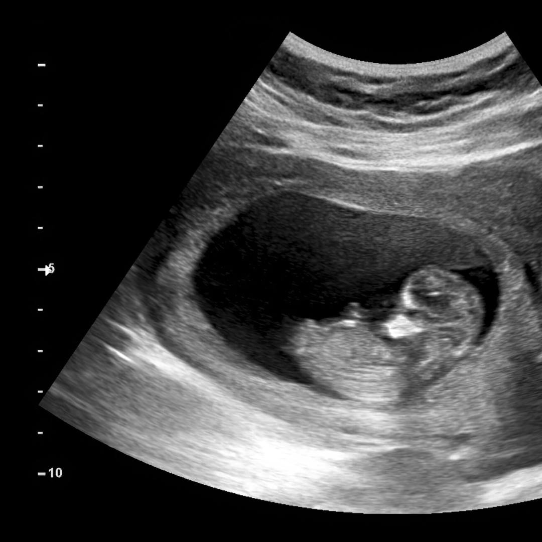 Photo shared by Karla for their Babylist baby registry.