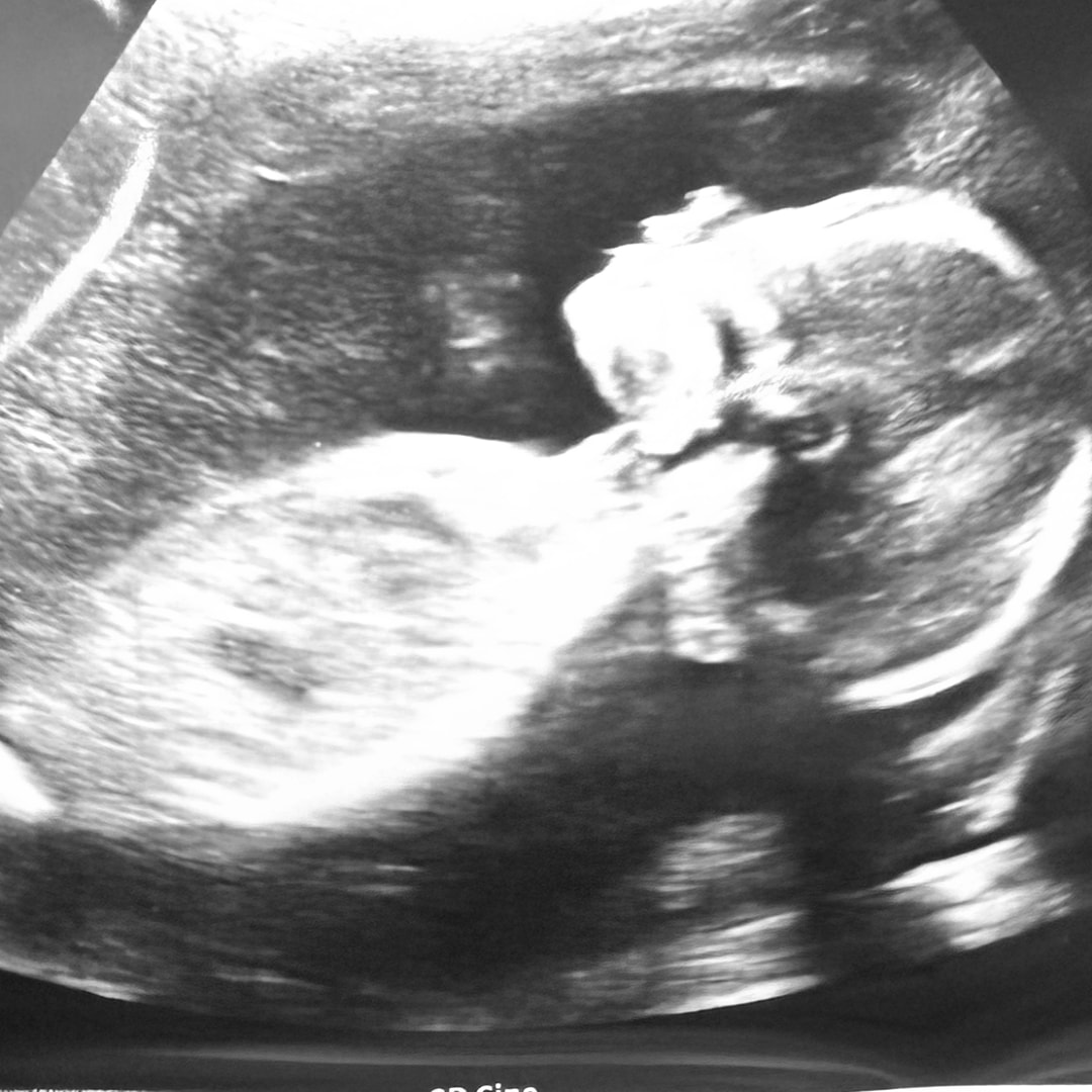 Photo shared by Daphne for their Babylist baby registry.