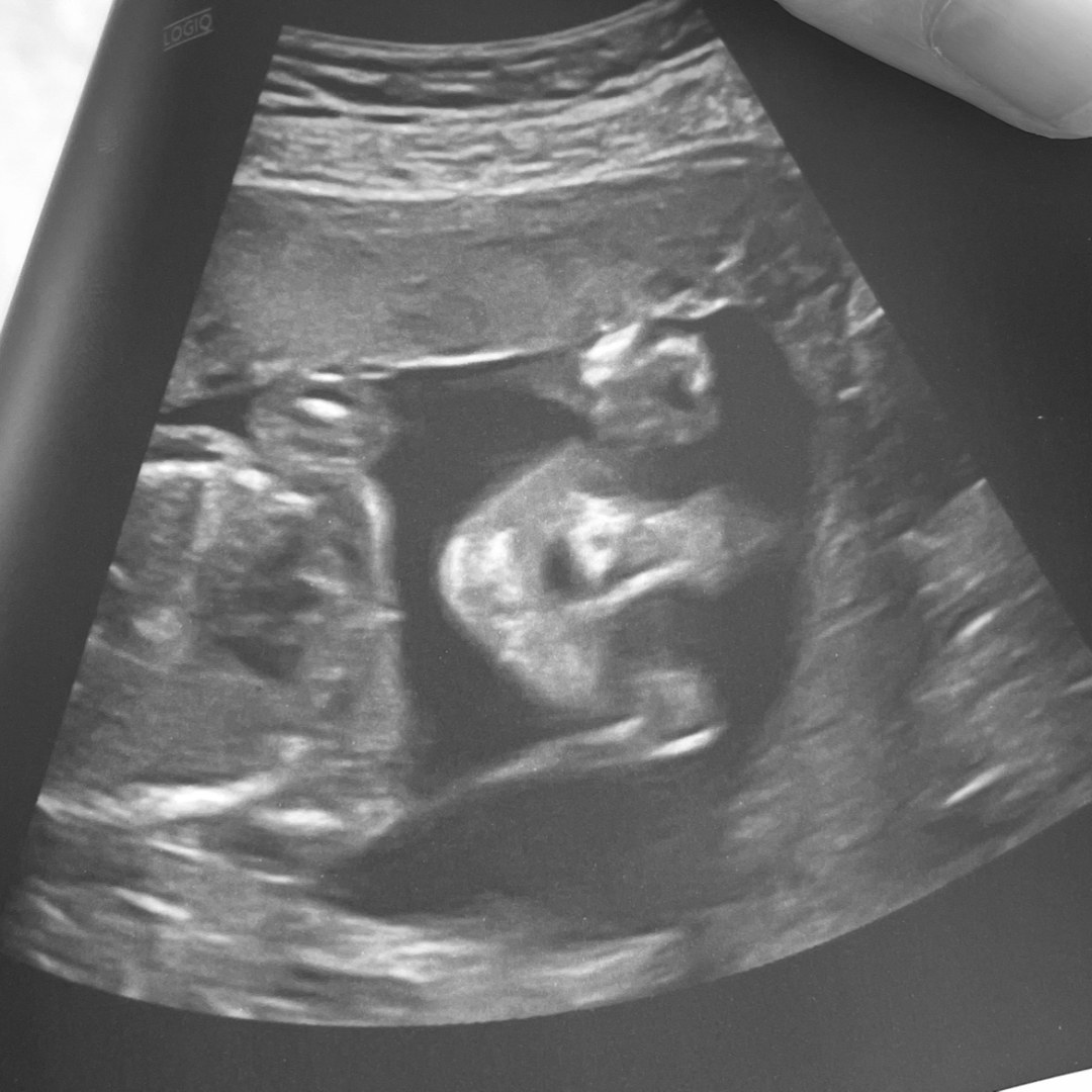 Photo shared by Cassandra for their Babylist baby registry.