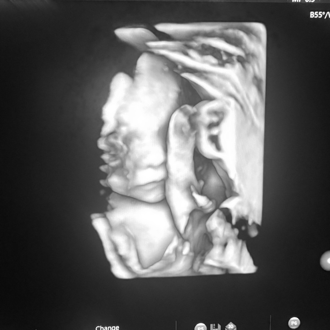 Photo shared by Katie for their Babylist baby registry.