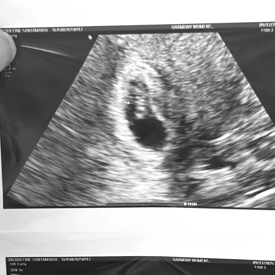 Photo shared by Jacqueline for their Babylist baby registry.