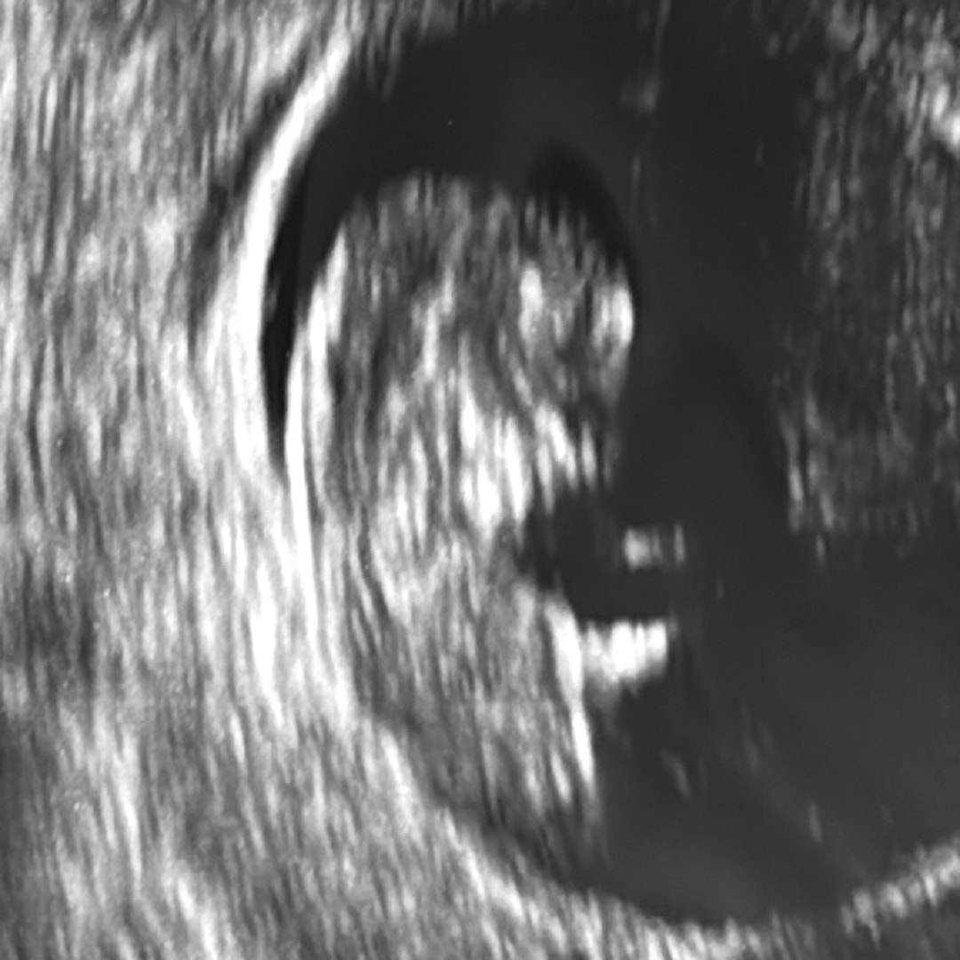 Photo shared by Cheyenne for their Babylist baby registry.