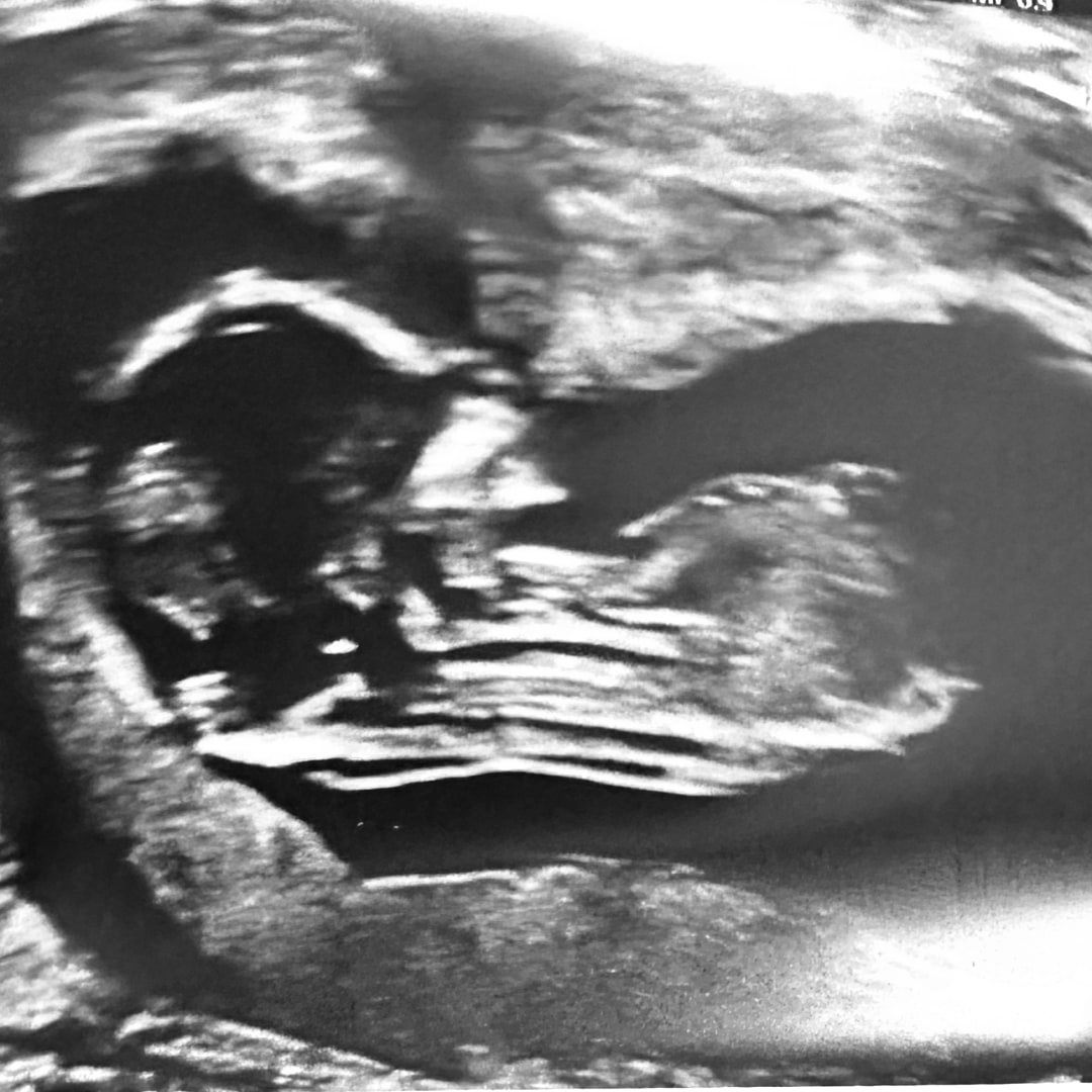 Photo shared by Citlali for their Babylist baby registry.