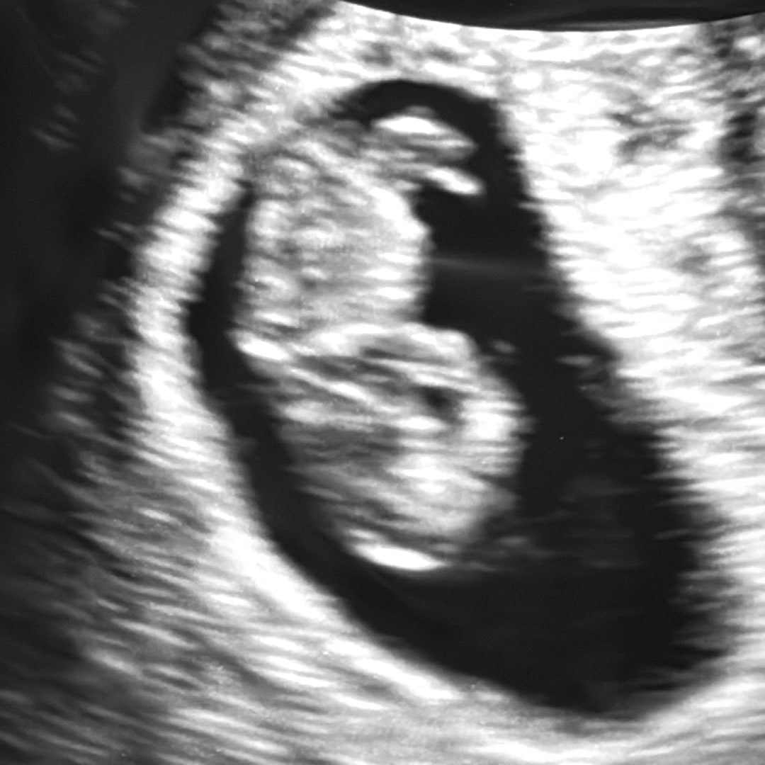 Photo shared by Cheyenne for their Babylist baby registry.