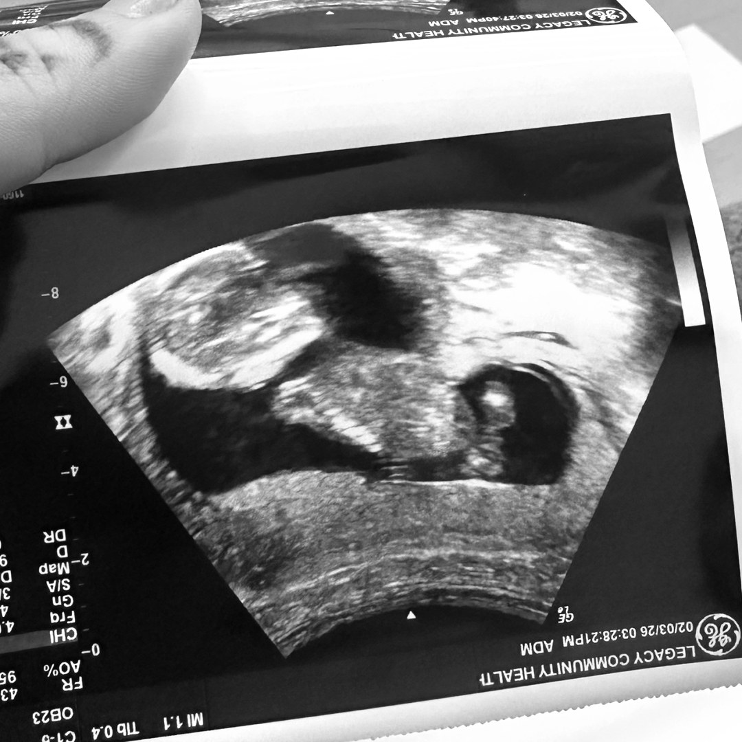 Photo shared by Jade for their Babylist baby registry.