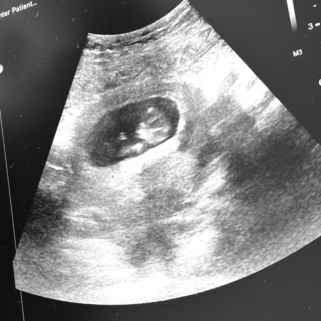 Photo shared by Jenny for their Babylist baby registry.