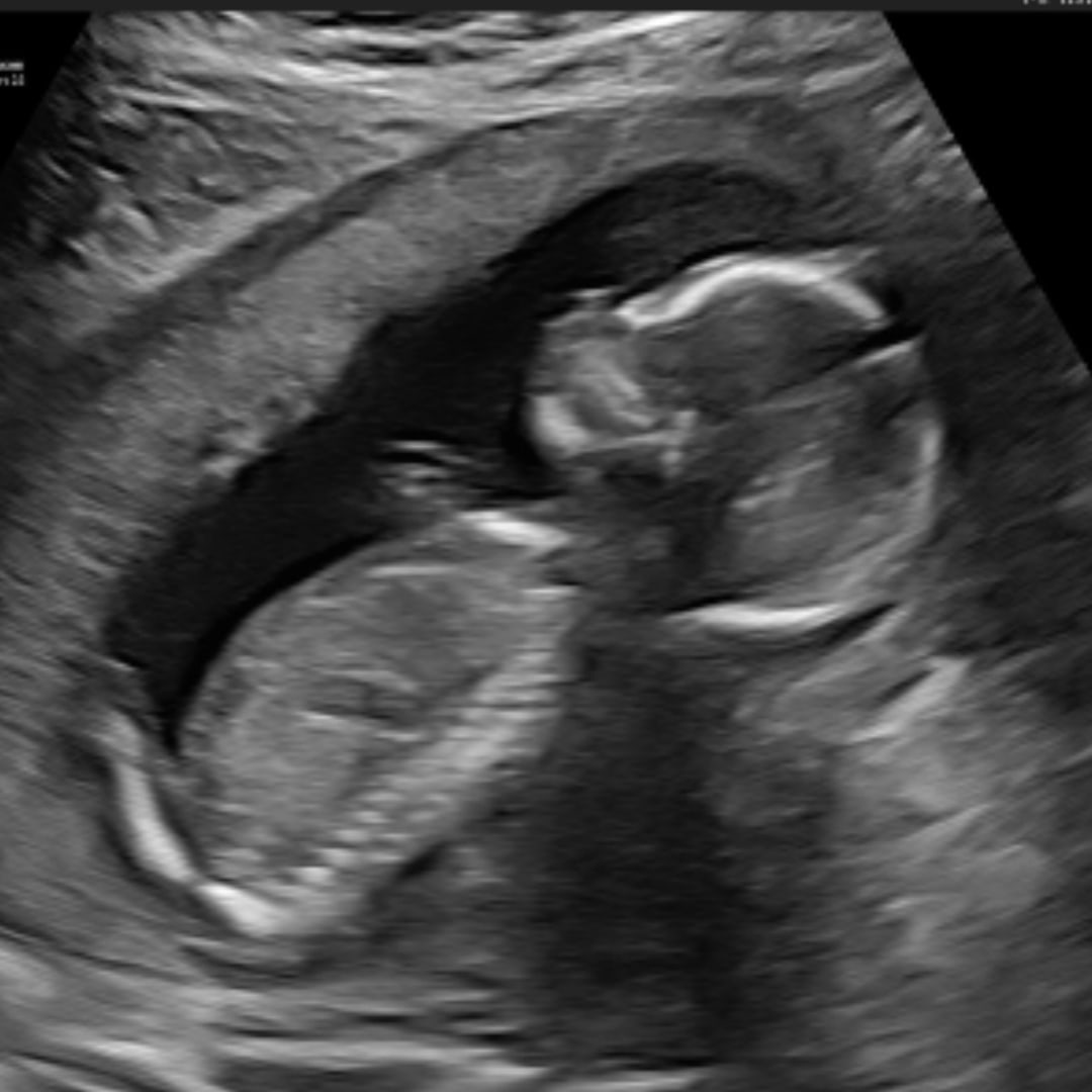 Photo shared by Arriana for their Babylist baby registry.
