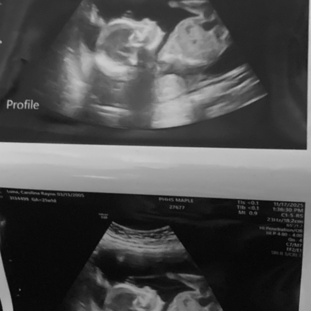 Photo shared by Carolina for their Babylist baby registry.