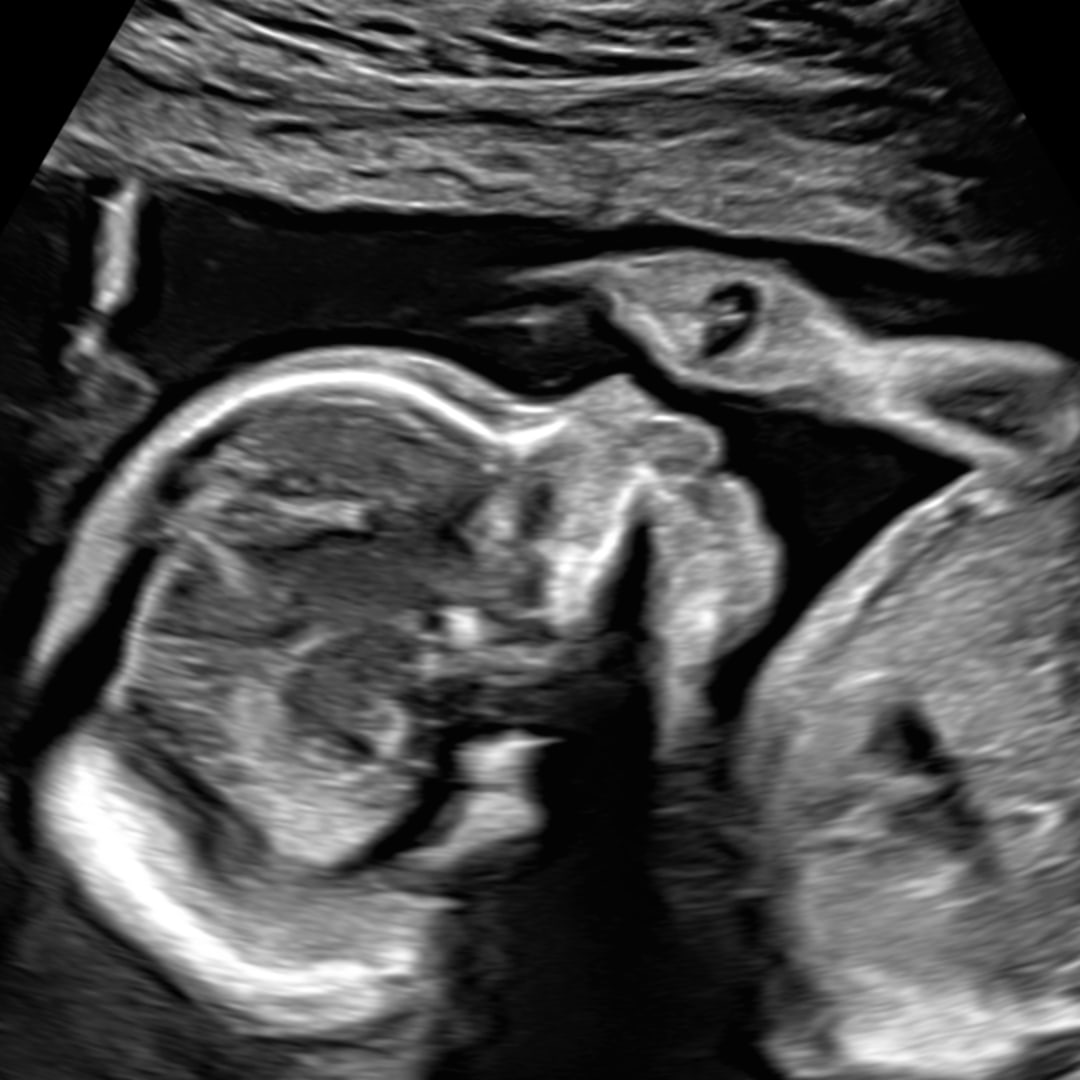 Photo shared by Daniel for their Babylist baby registry.