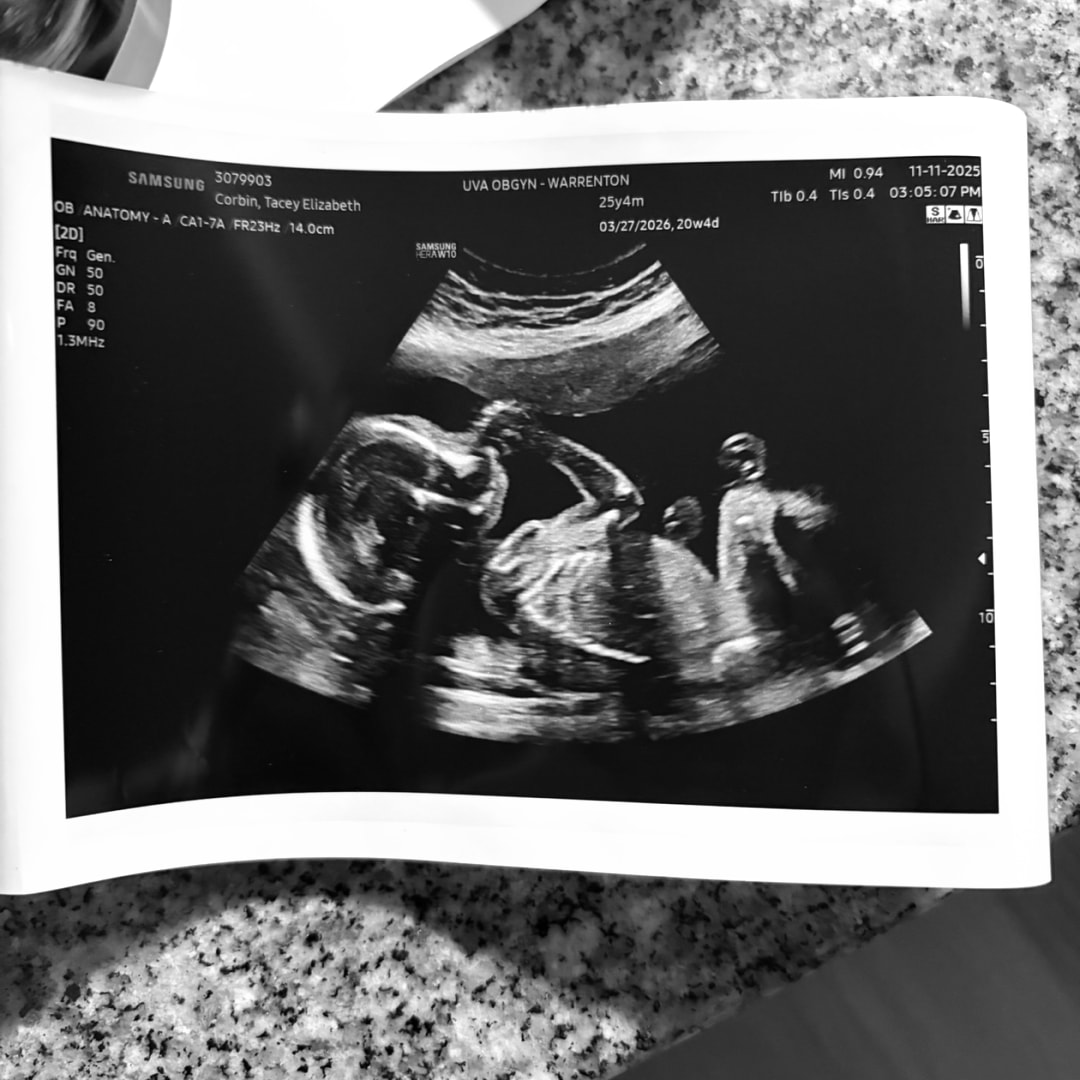 Photo shared by Tacey for their Babylist baby registry.