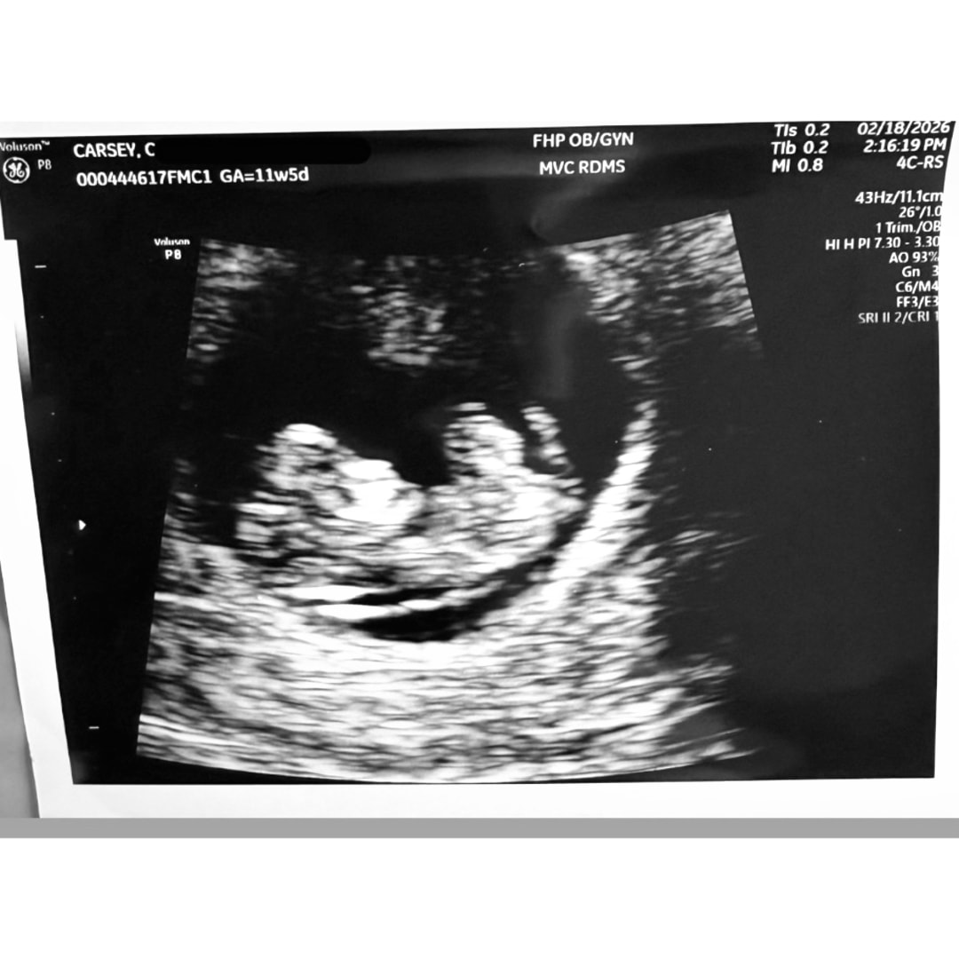 Photo shared by Cailyn for their Babylist baby registry.