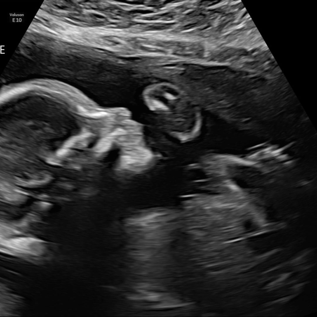 Photo shared by Elizabeth for their Babylist baby registry.