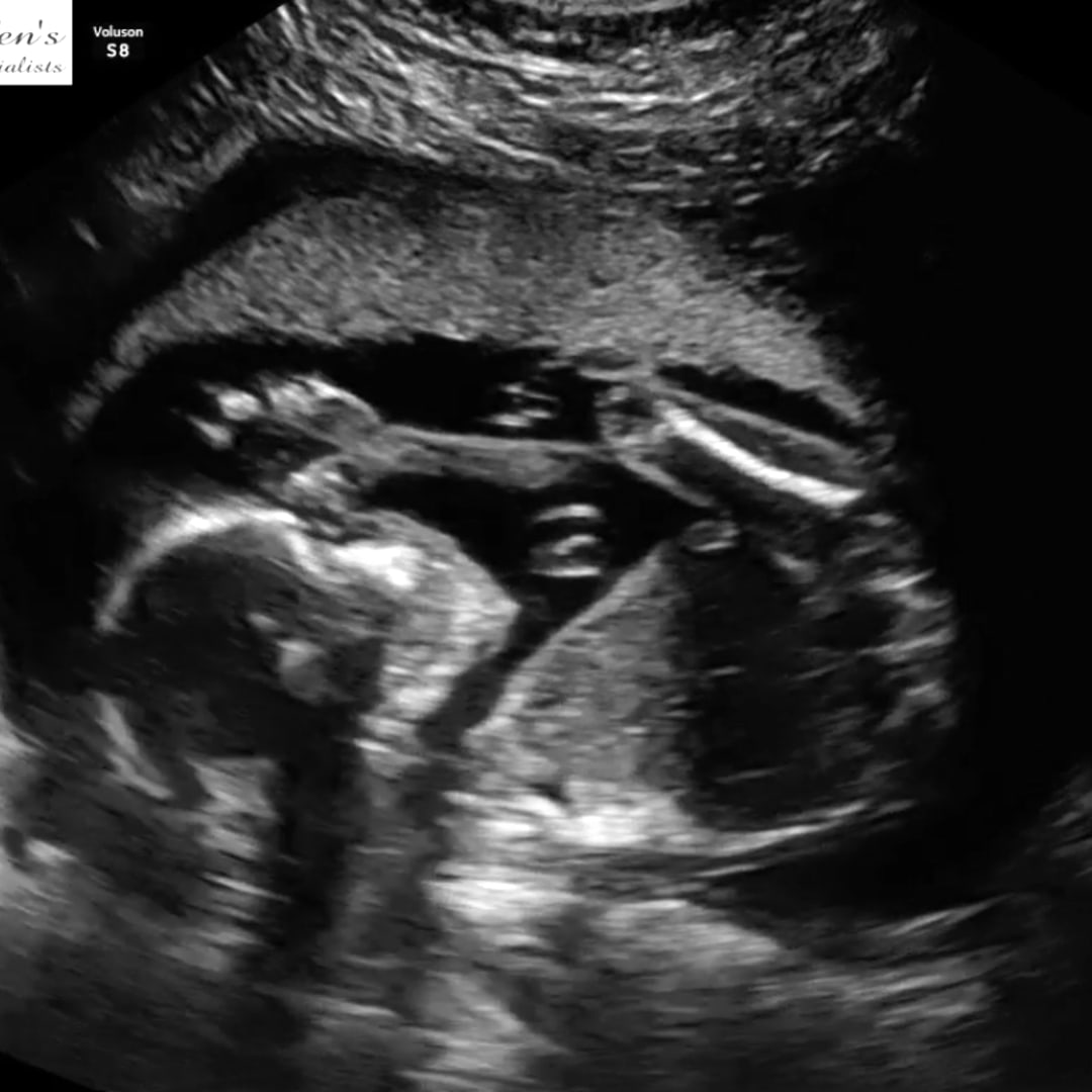 Photo shared by Mollie for their Babylist baby registry.