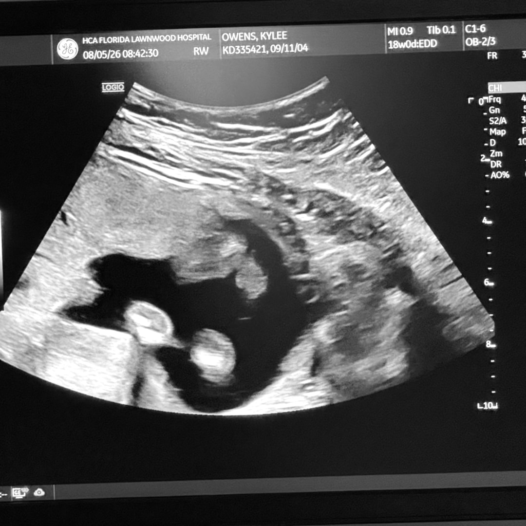 Photo shared by Kylee for their Babylist baby registry.