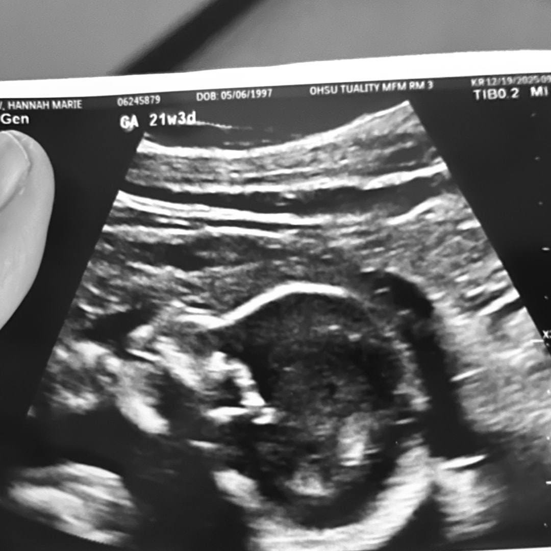 Photo shared by Hannah for their Babylist baby registry.