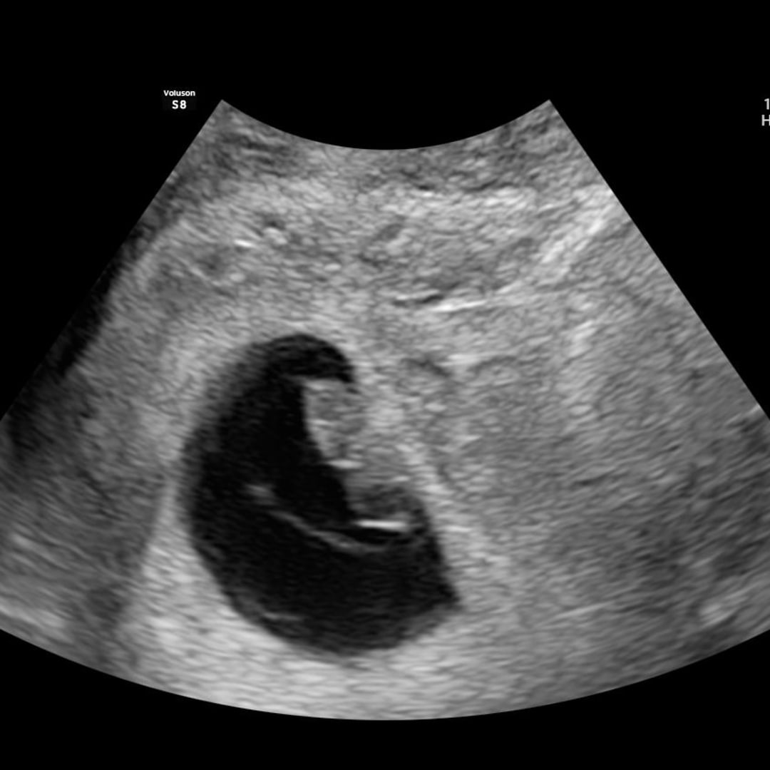 Photo shared by Hannah for their Babylist baby registry.