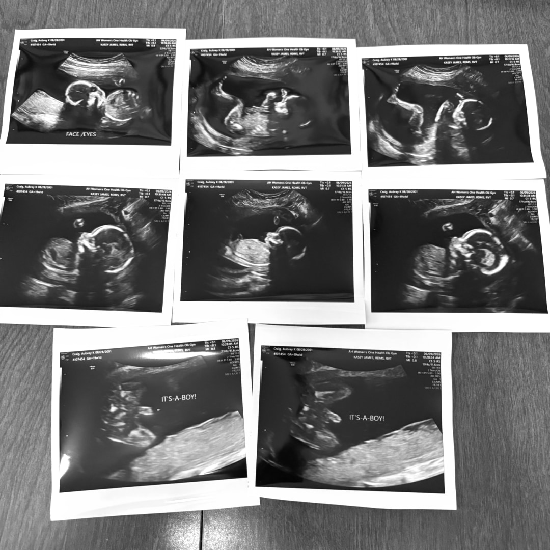 Photo shared by Aubrey for their Babylist baby registry.