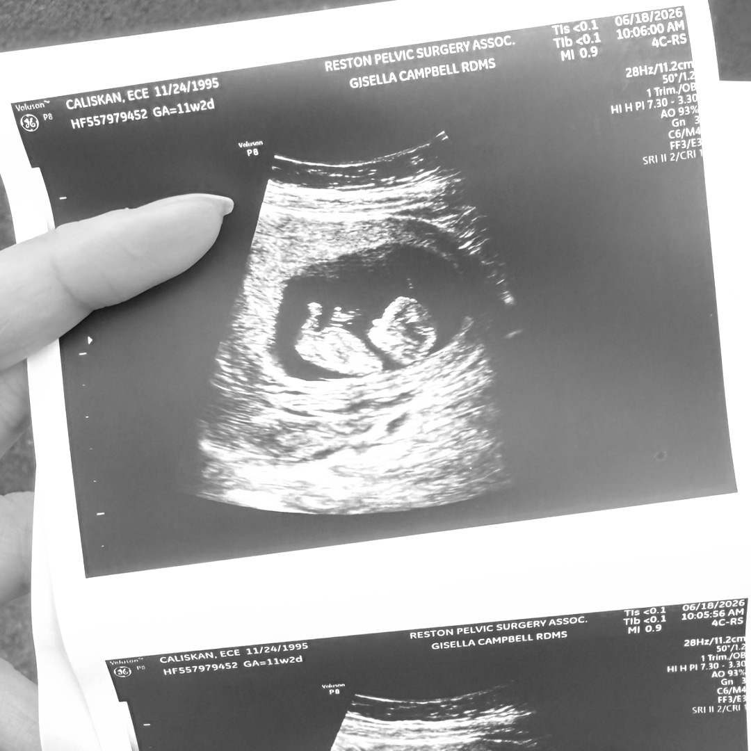 Photo shared by Ece for their Babylist baby registry.