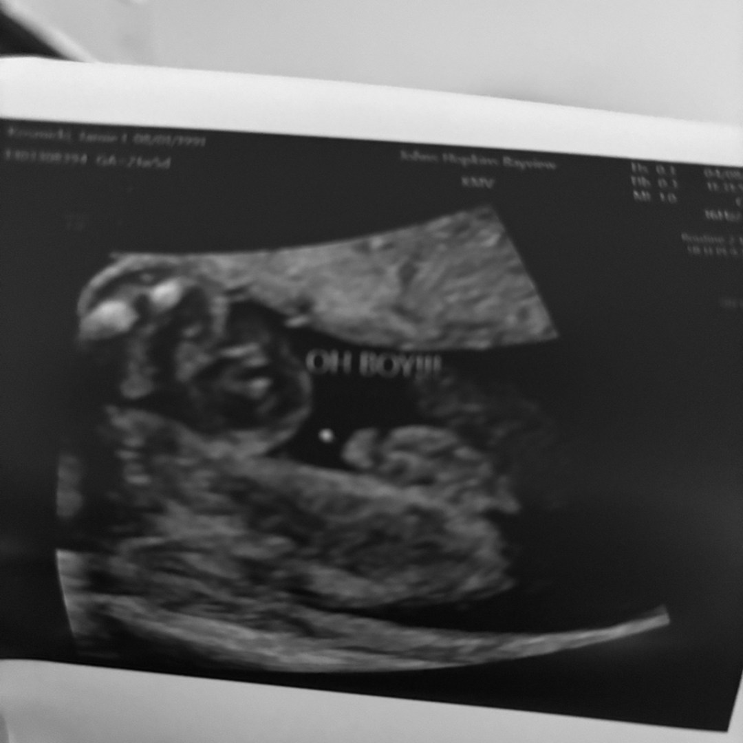 Photo shared by Jamie for their Babylist baby registry.