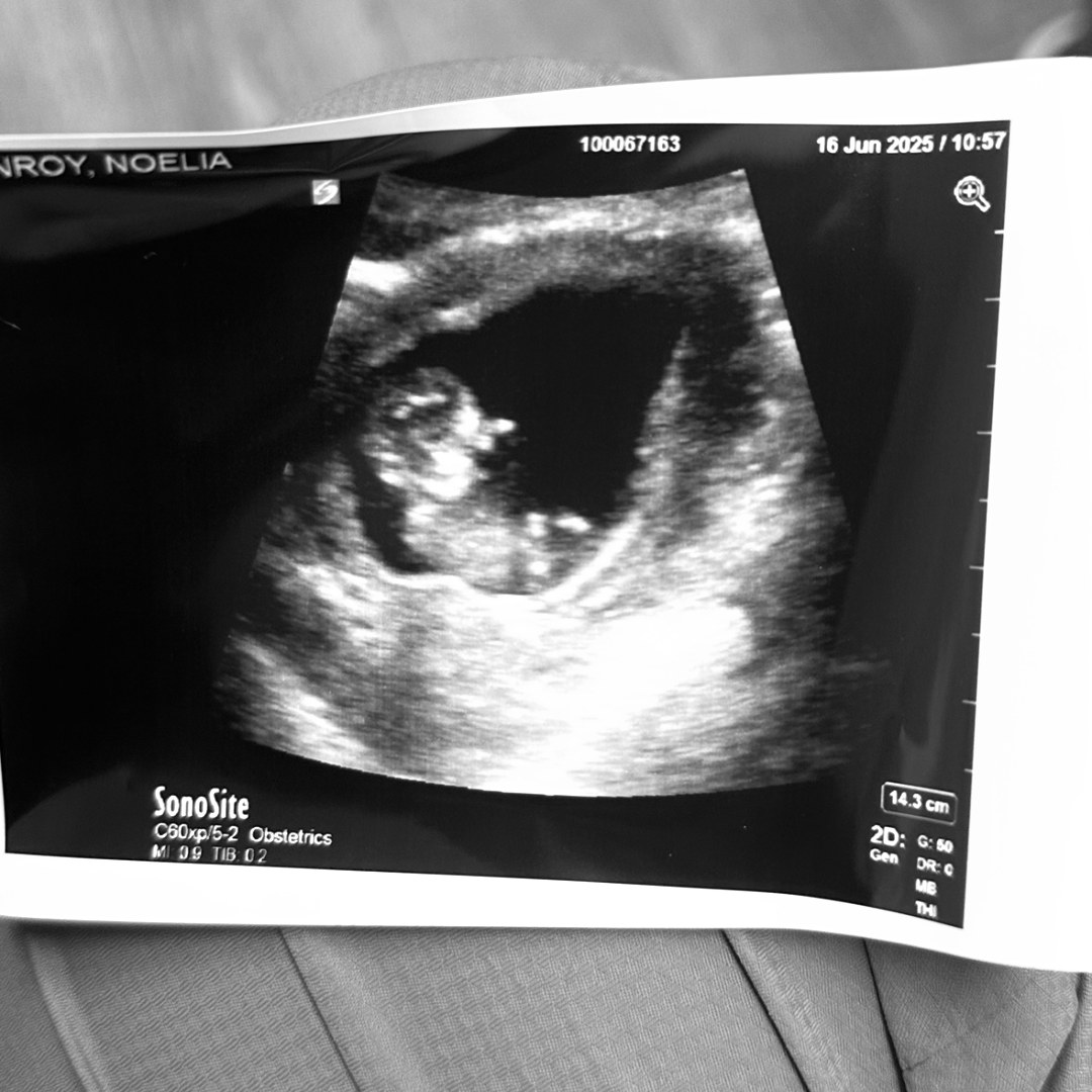 Photo shared by Noelia for their Babylist baby registry.