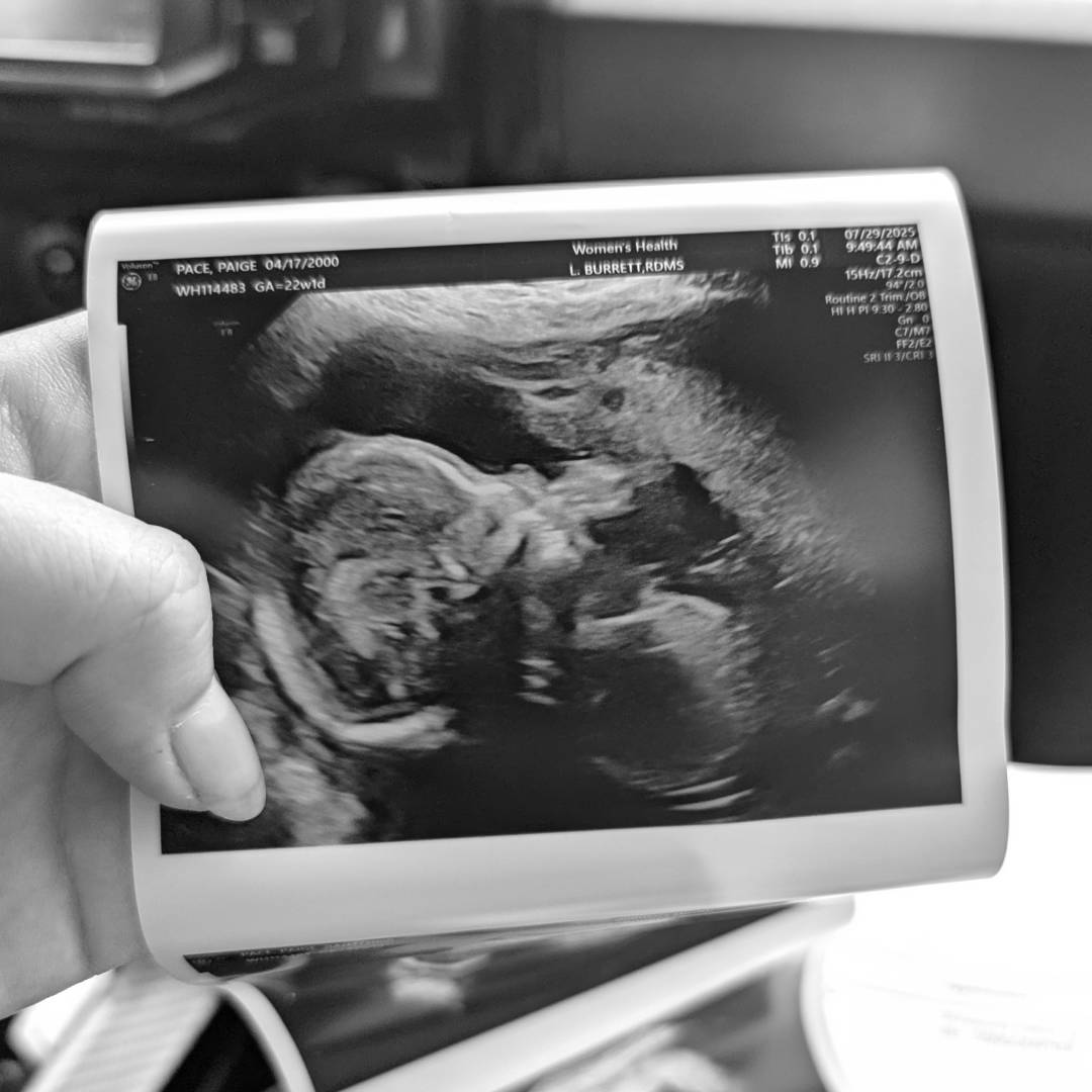 Photo shared by Paige for their Babylist baby registry.