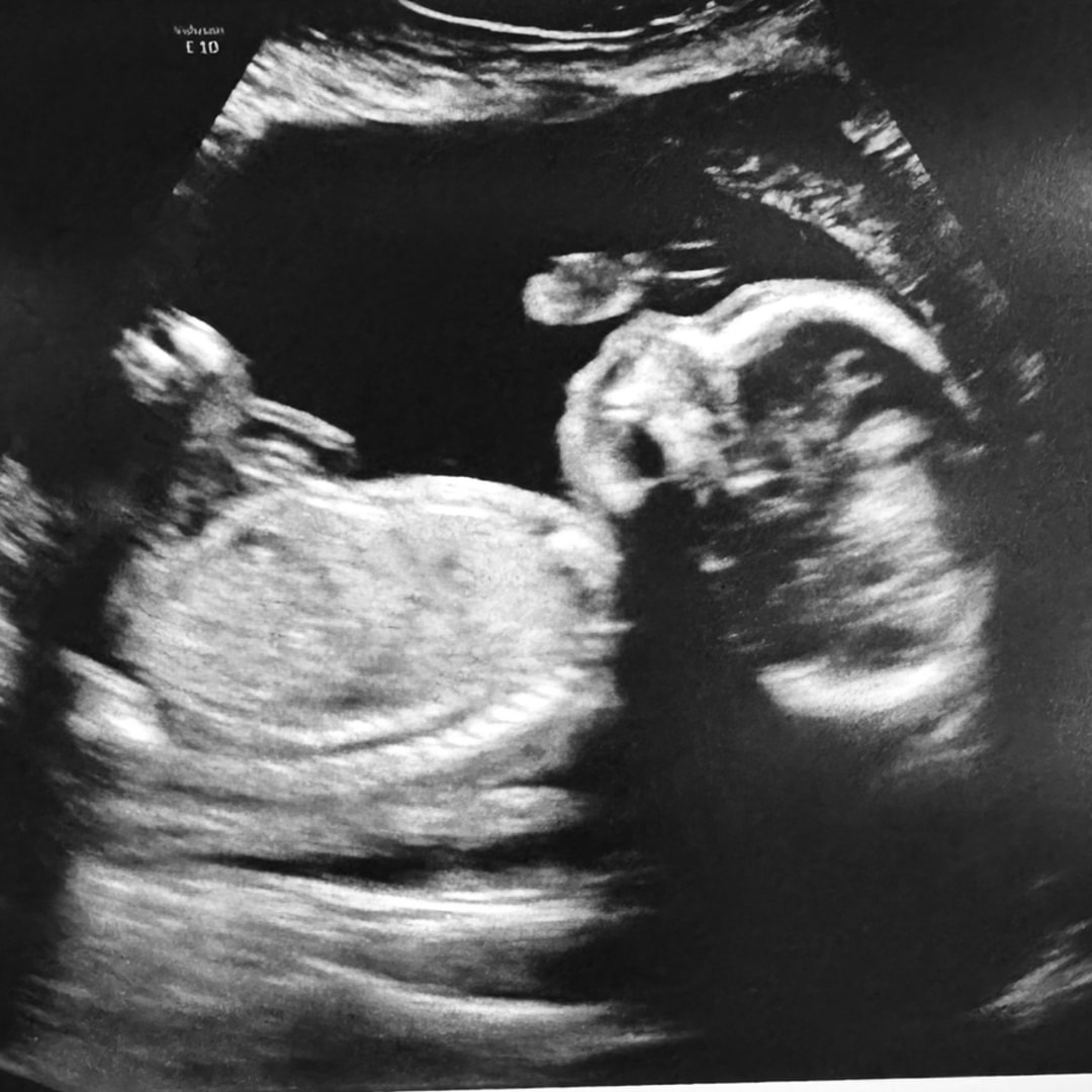 Photo shared by Liz for their Babylist baby registry.
