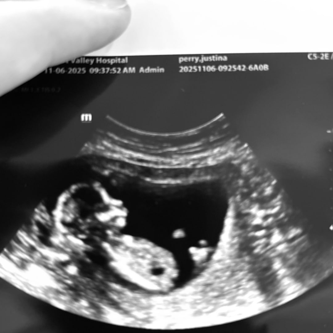 Photo shared by Justina for their Babylist baby registry.