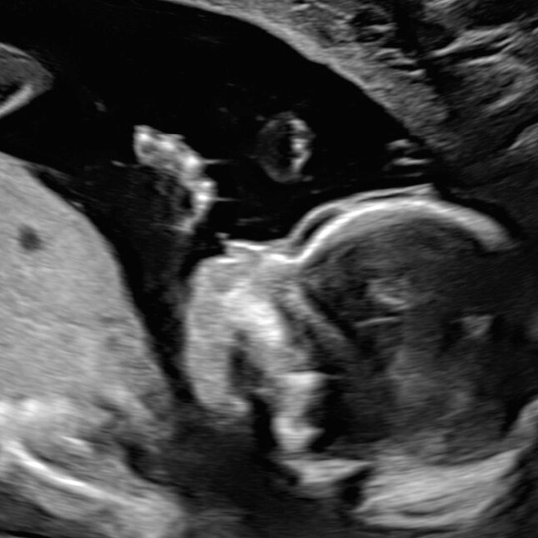 Photo shared by Chrissy for their Babylist baby registry.