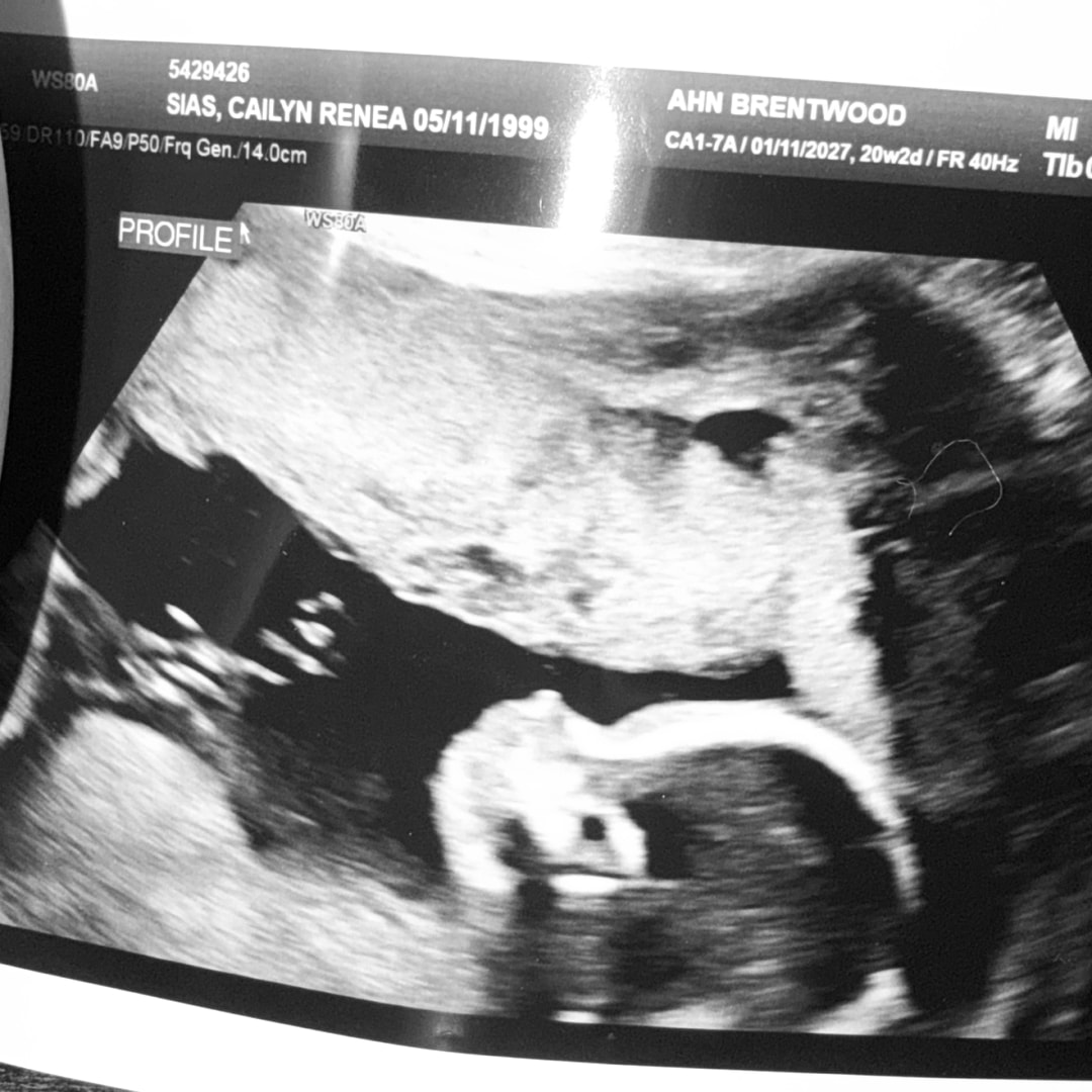 Photo shared by Cailyn for their Babylist baby registry.