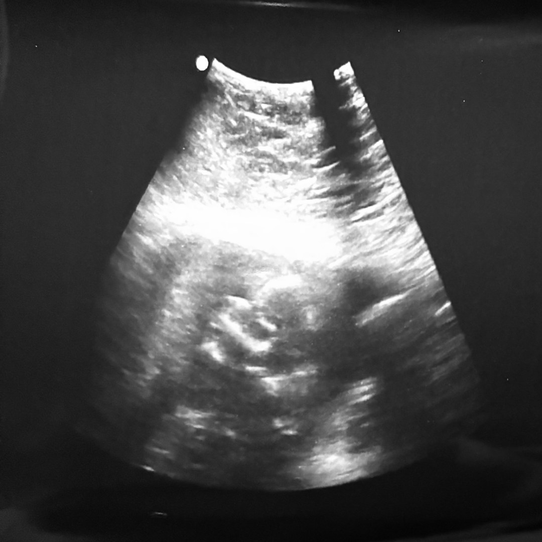 Photo shared by Bethany for their Babylist baby registry.