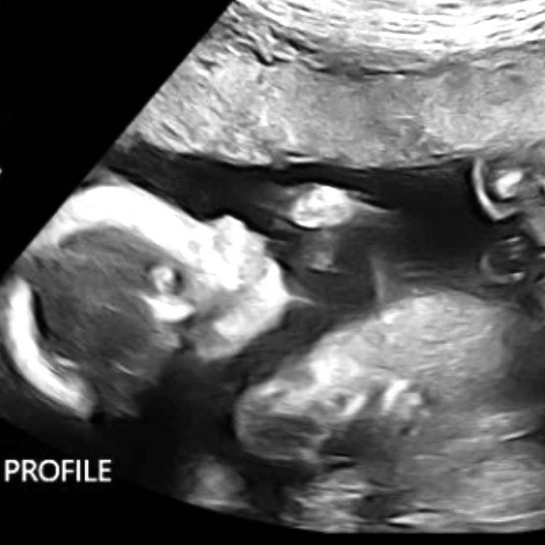 Photo shared by Glory for their Babylist baby registry.