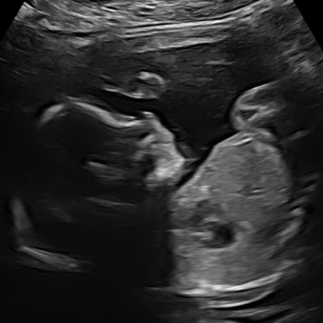 Photo shared by Ainsley for their Babylist baby registry.