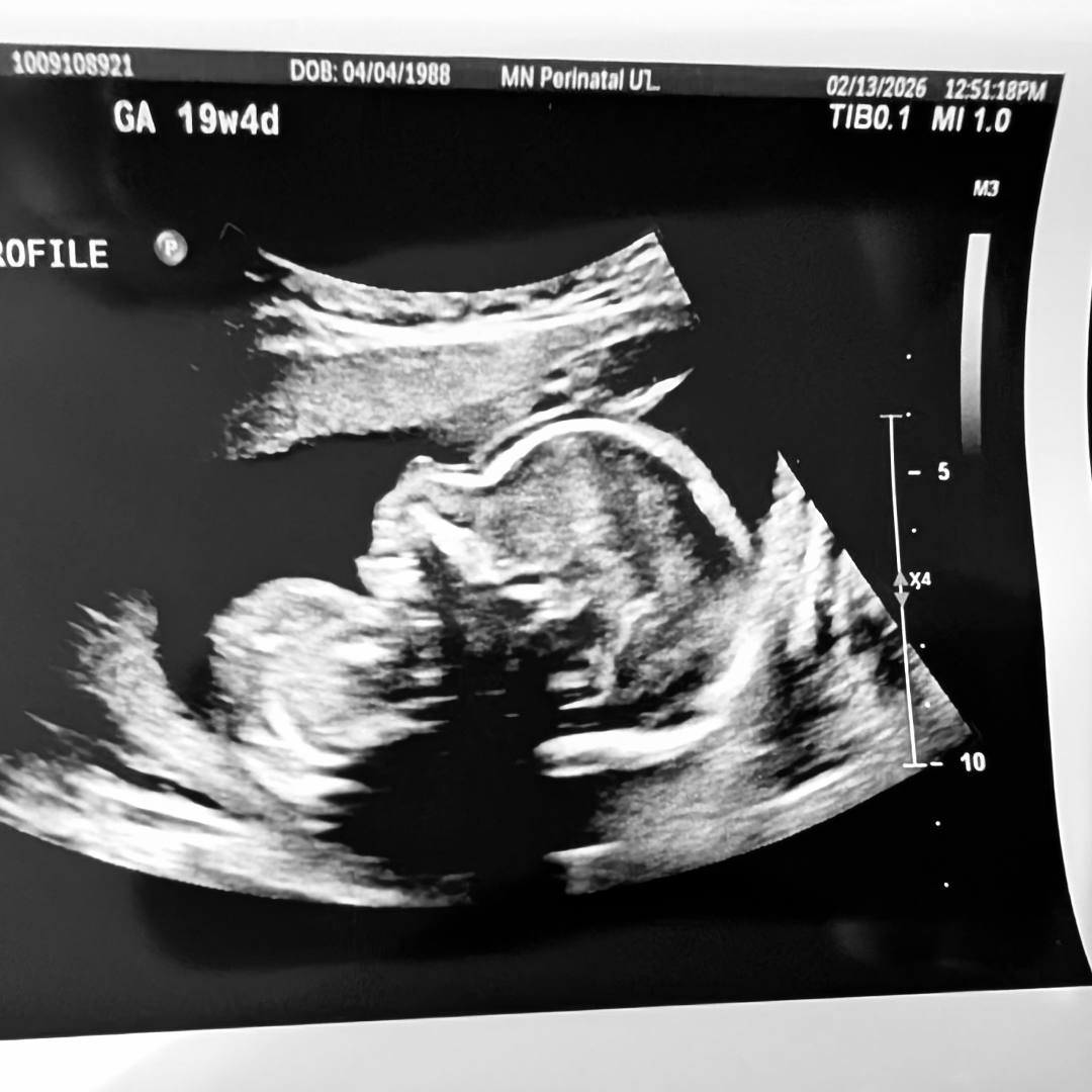 Photo shared by Katrina for their Babylist baby registry.