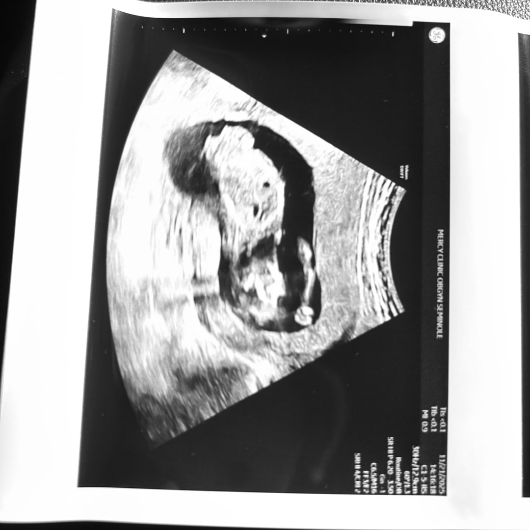 Photo shared by Taylor for their Babylist baby registry.