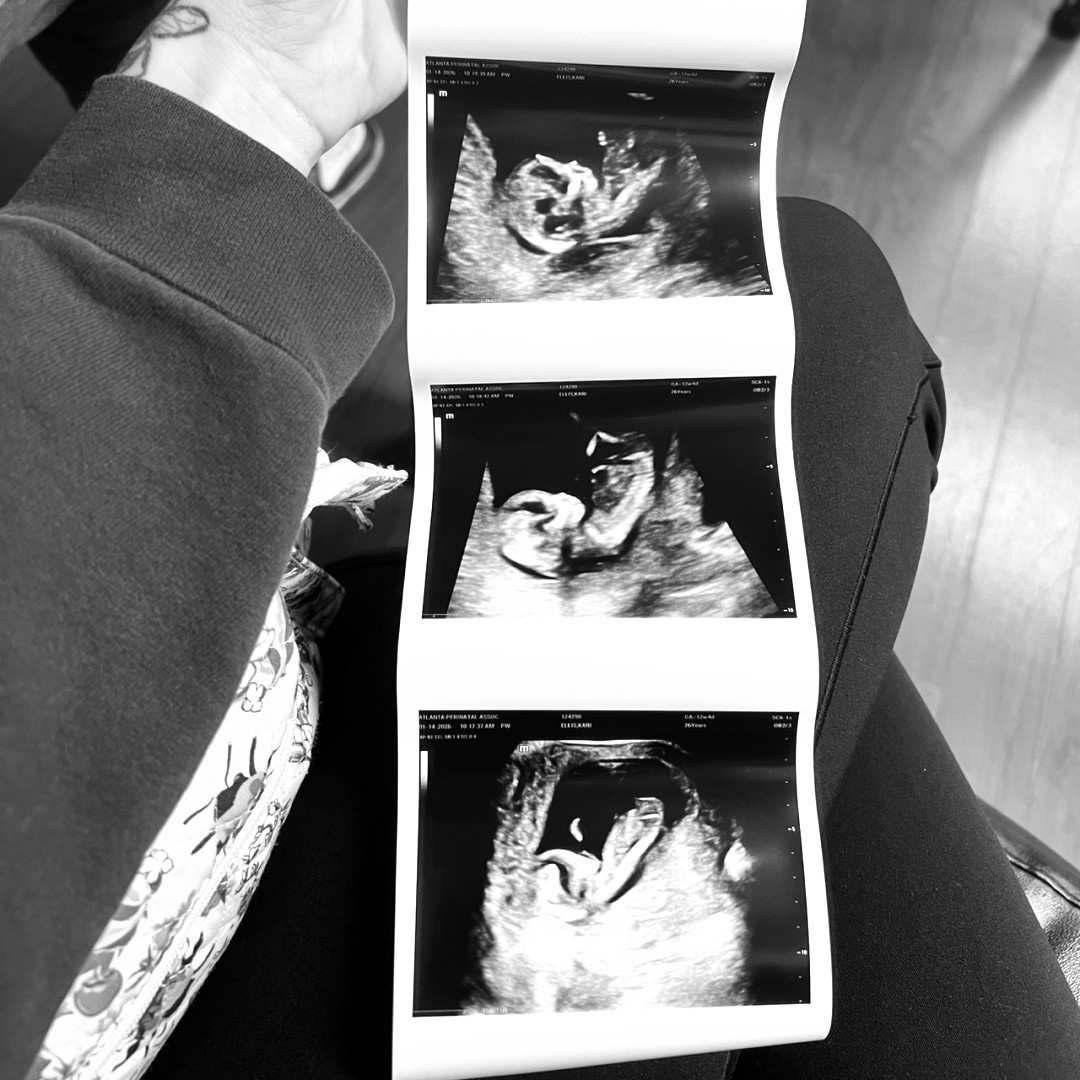 Photo shared by Kari for their Babylist baby registry.