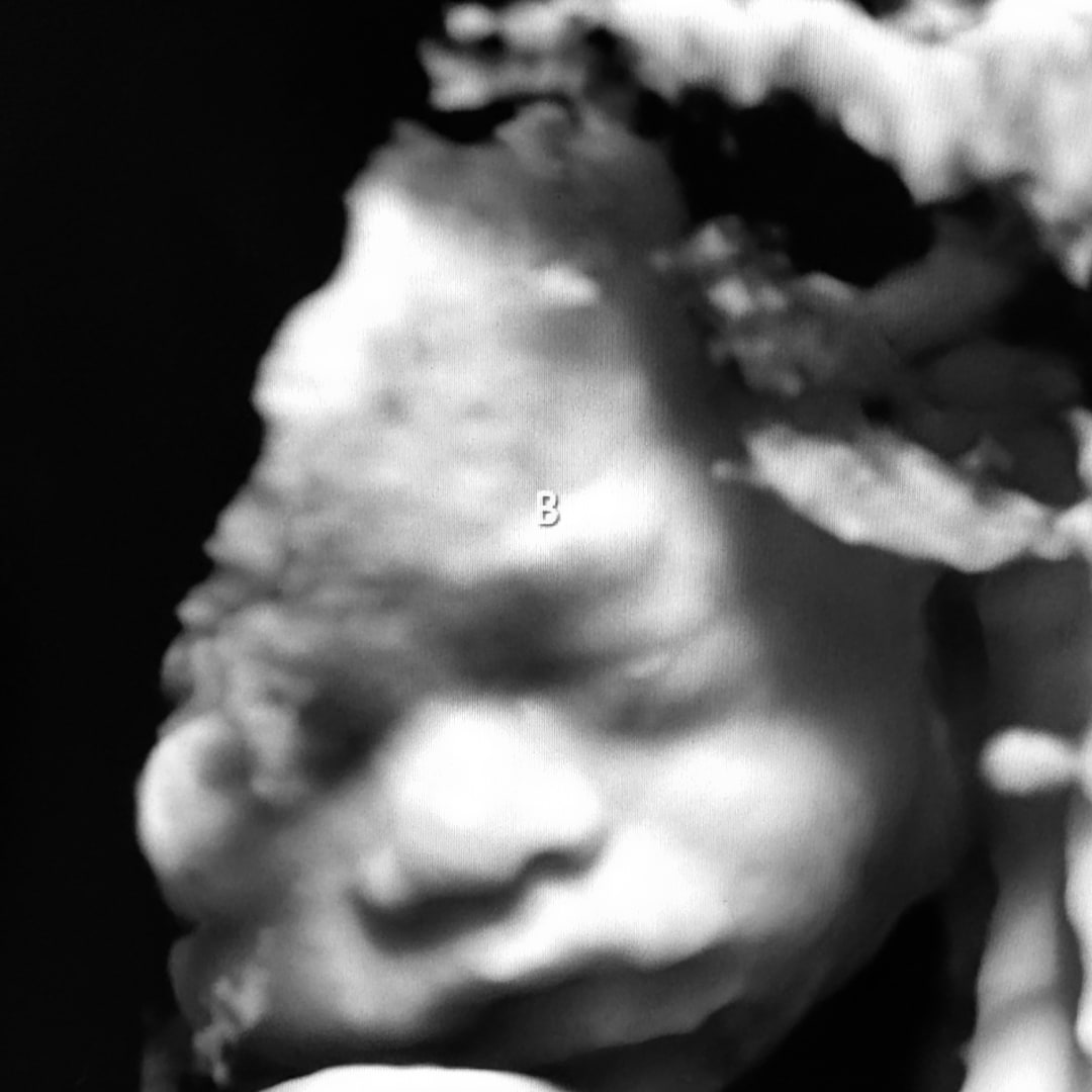 Photo shared by Valerie for their Babylist baby registry.