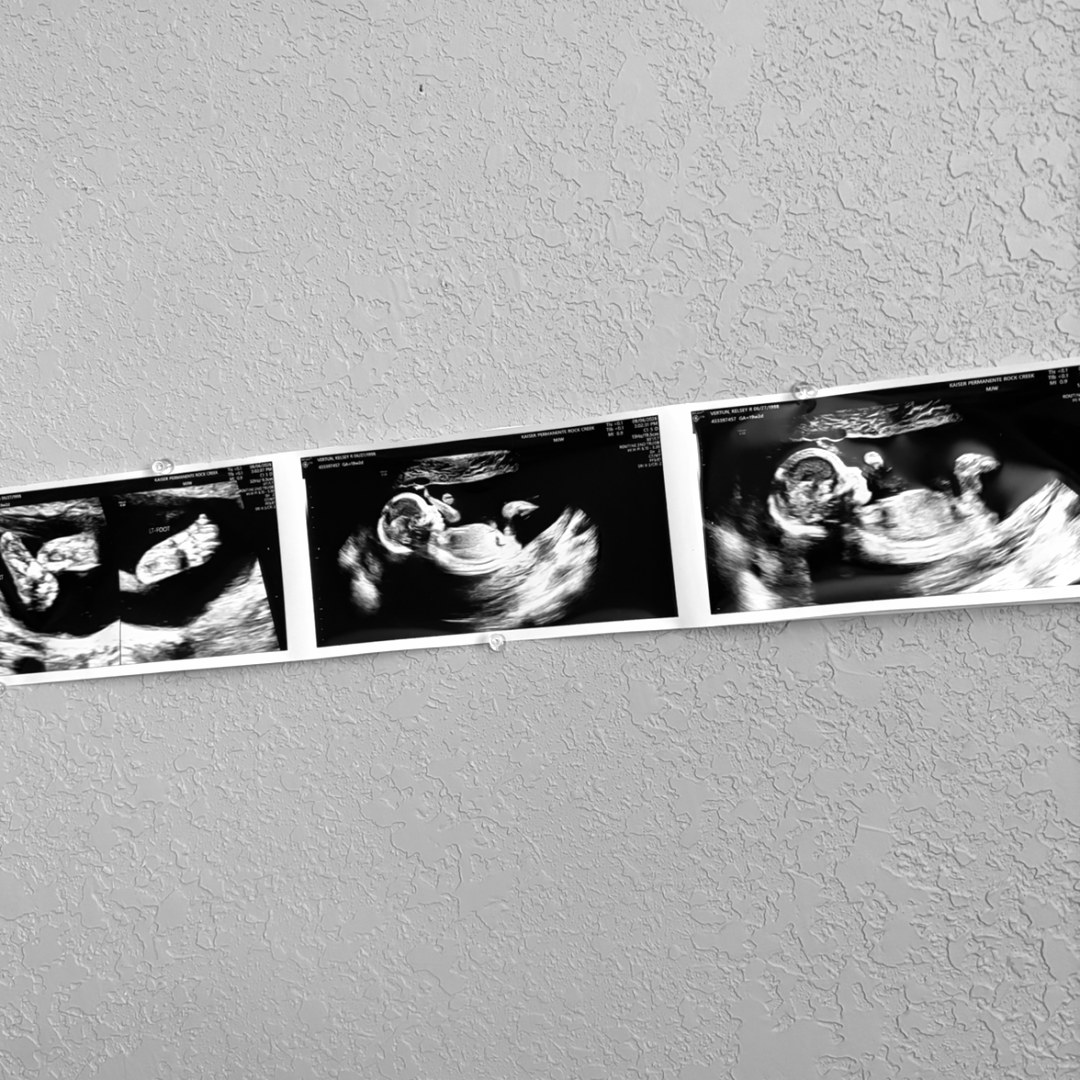 Photo shared by Kelsey for their Babylist baby registry.
