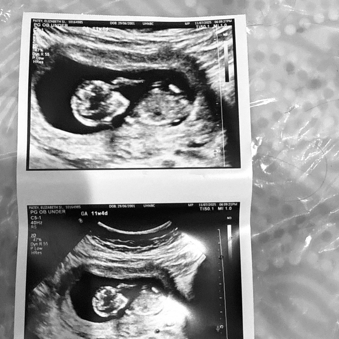 Photo shared by Elizabeth for their Babylist baby registry.
