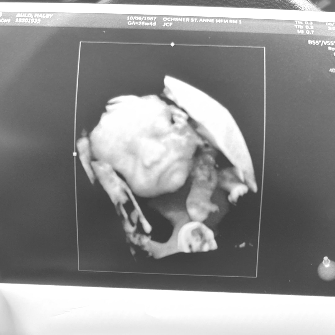 Photo shared by Haley for their Babylist baby registry.