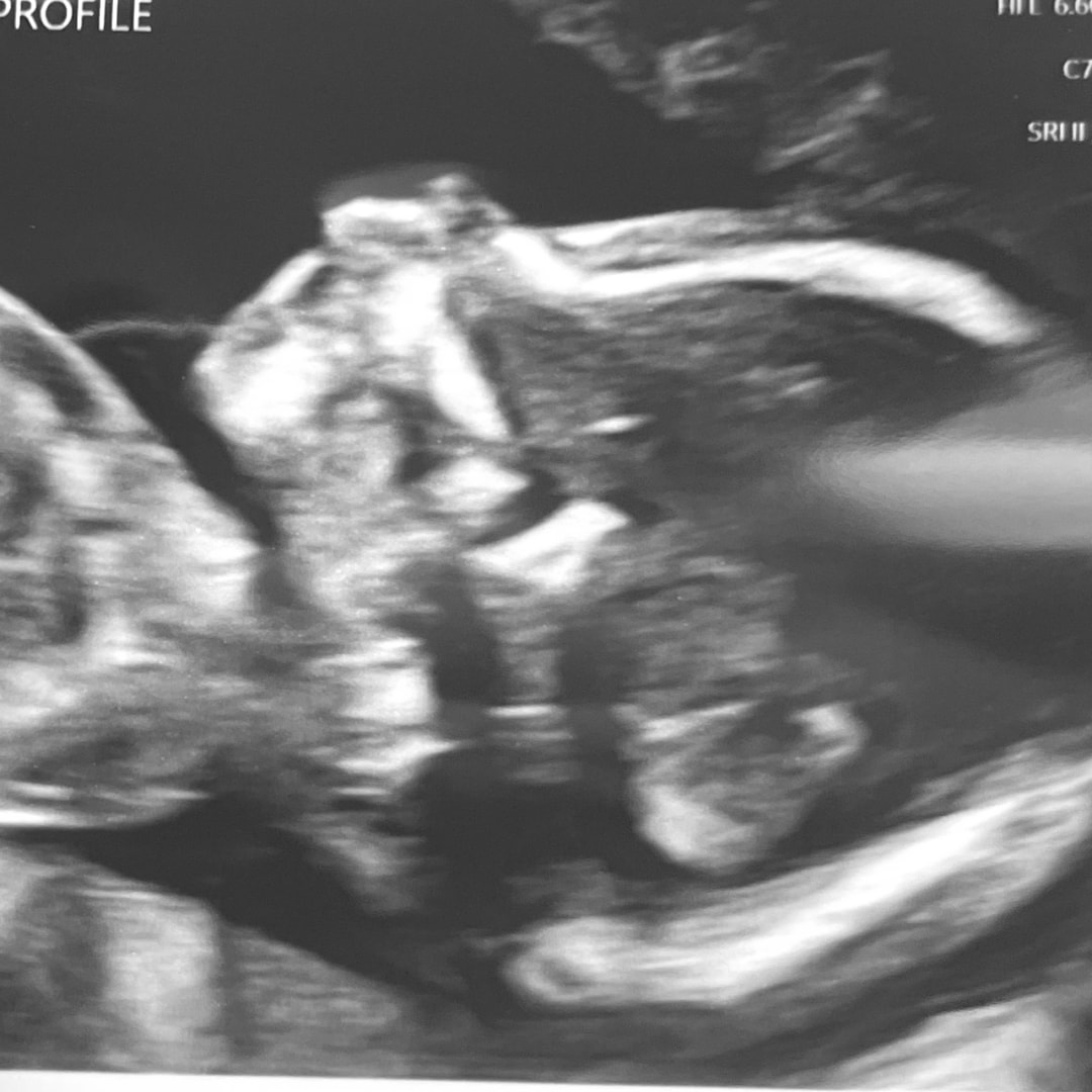 Photo shared by Erin for their Babylist baby registry.