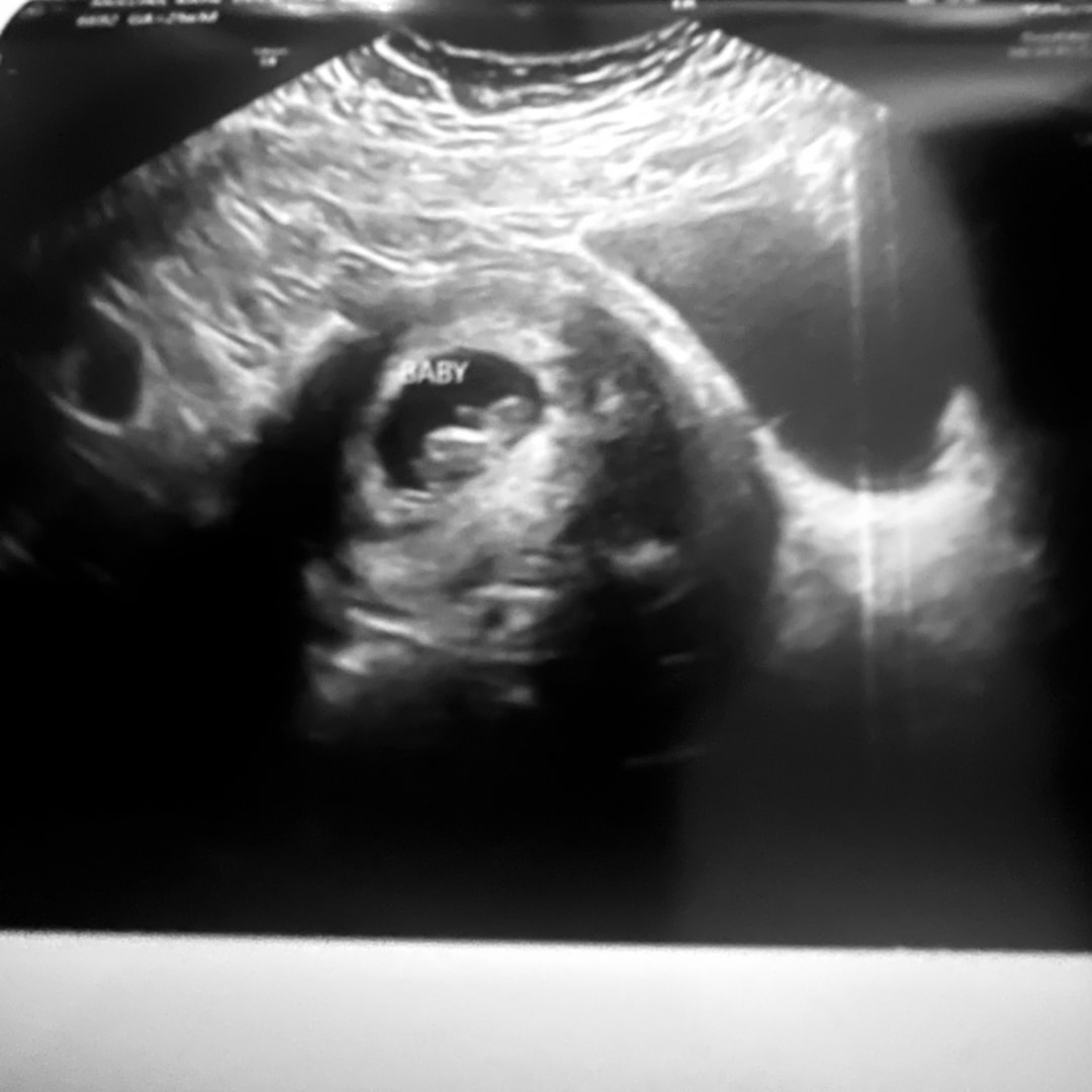 Photo shared by Katie for their Babylist baby registry.