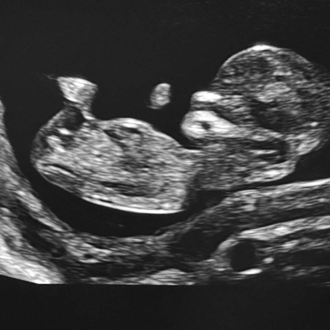 Photo shared by Emilie for their Babylist baby registry.