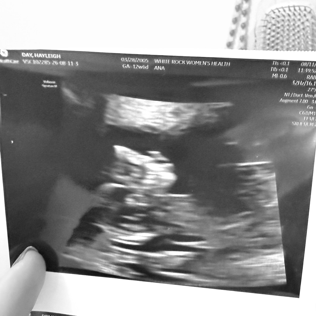 Photo shared by Hayleigh for their Babylist baby registry.