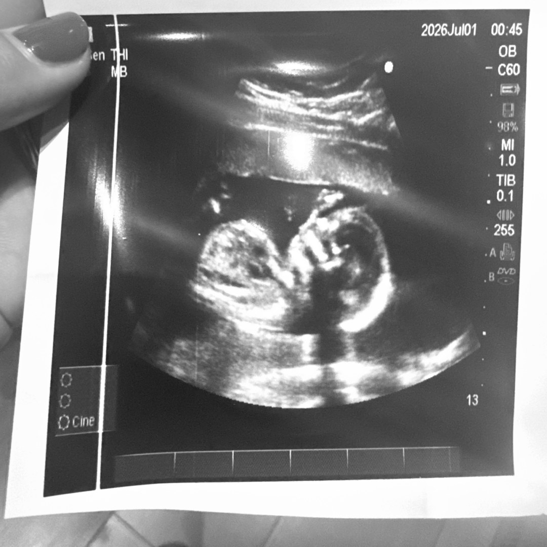 Photo shared by Alli for their Babylist baby registry.