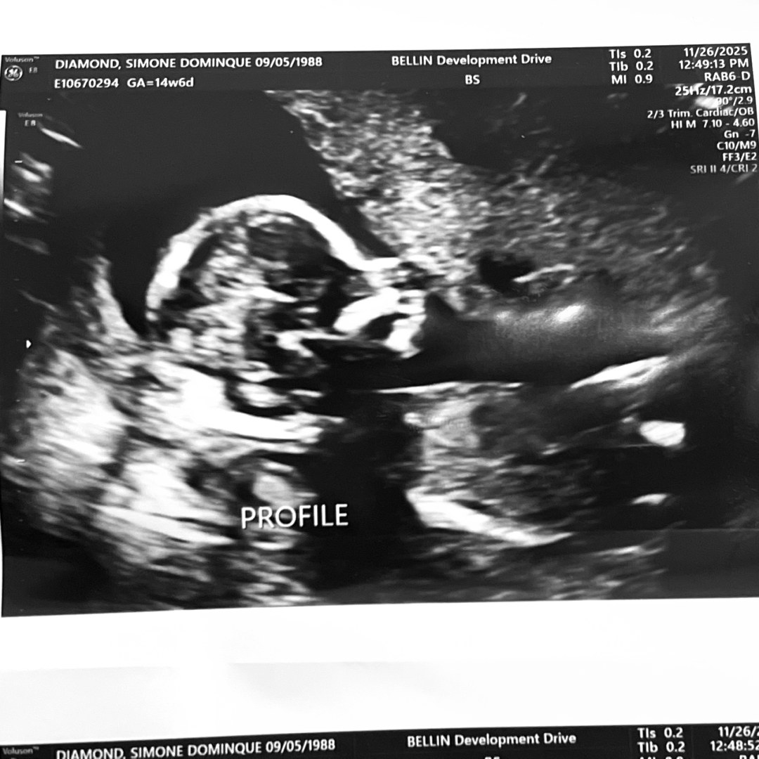 Photo shared by Simone for their Babylist baby registry.