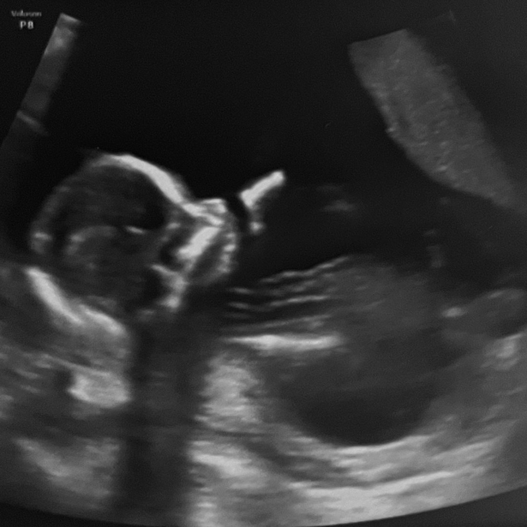 Photo shared by Rachel for their Babylist baby registry.