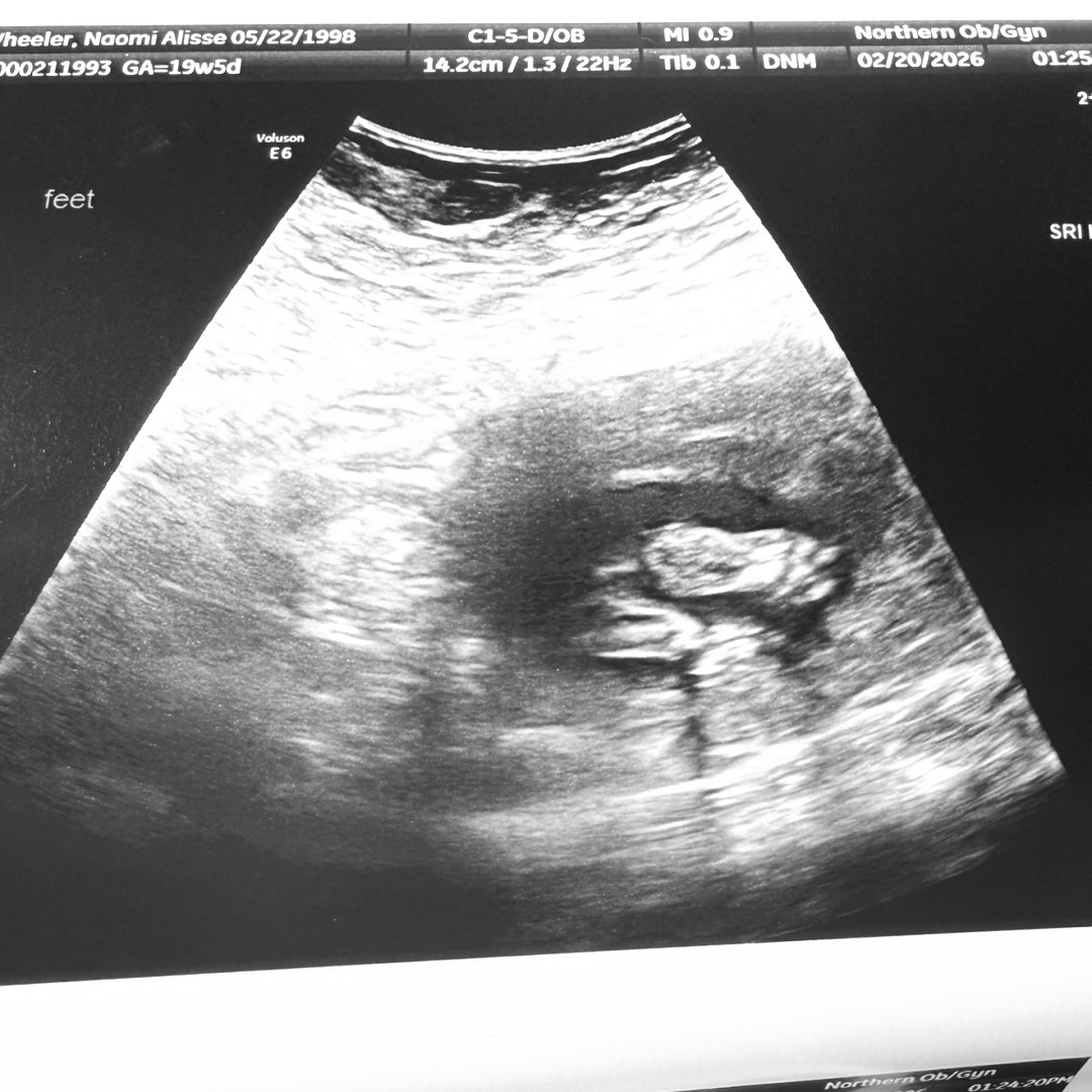 Photo shared by Naomi for their Babylist baby registry.