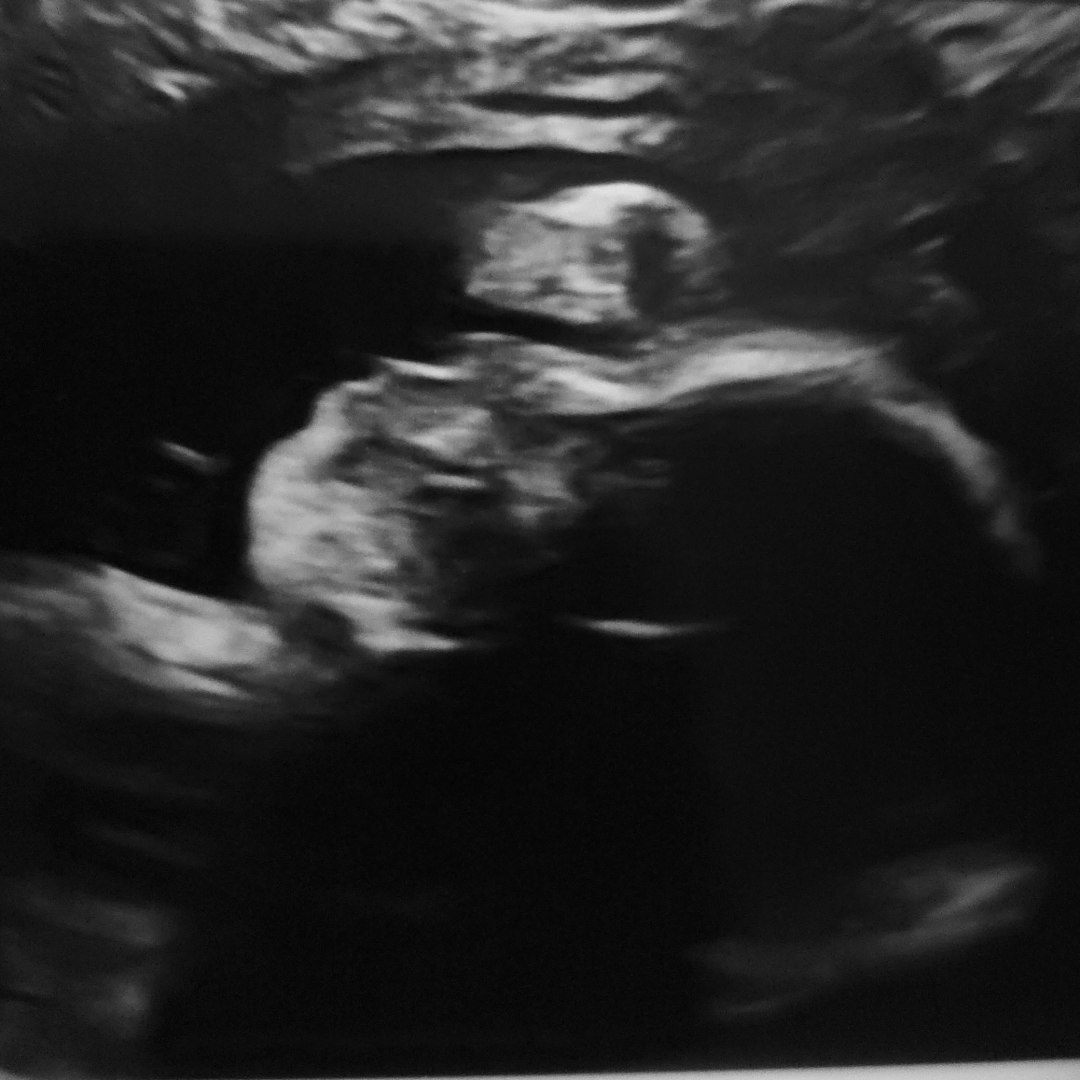 Photo shared by Misty for their Babylist baby registry.